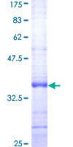 Novus Biologicals Recombinant Human SDHD GST (N-Term) Protein 10 &mu;g | Buy Online | Novus Biologicals&trade; | Fisher Scientific