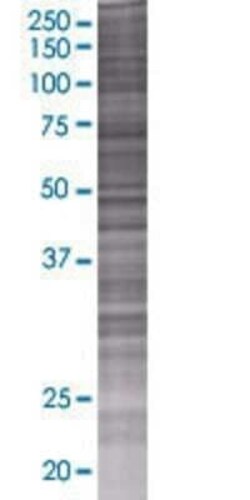 Novus Biologicals SEC13 293T Cell Transient Overexpression Lysate 0.1 mL | Buy Online | Novus Biologicals&trade; | Fisher Scientific