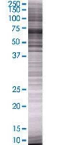 Novus Biologicals&trade;&nbsp;Semenogelin II 293T Cell Transient Overexpression Lysate