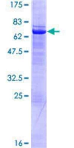 Novus Biologicals Recombinant Human SETMAR GST (N-Term) Protein 10 &mu;g | Buy Online | Novus Biologicals&trade; | Fisher Scientific