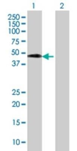 Novus Biologicals SETMAR 293T Cell Transient Overexpression Lysate 0.1 mL | Buy Online | Novus Biologicals&trade; | Fisher Scientific
