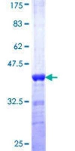 Novus Biologicals Recombinant Human SFPQ GST (N-Term) Protein 10 &mu;g | Buy Online | Novus Biologicals&trade; | Fisher Scientific