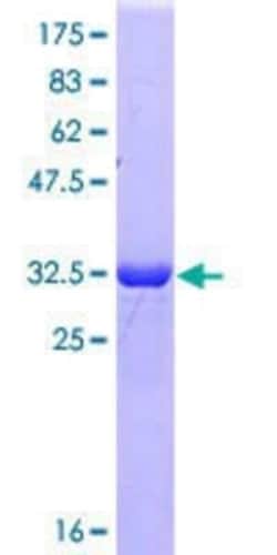 Novus Biologicals Recombinant Human SFRS3 GST (N-Term) Protein 25 &mu;g | Buy Online | Novus Biologicals&trade; | Fisher Scientific