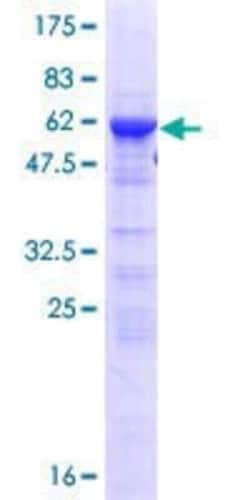 Novus Biologicals Recombinant Human SFRS5 GST (N-Term) Protein 25 &mu;g | Buy Online | Novus Biologicals&trade; | Fisher Scientific