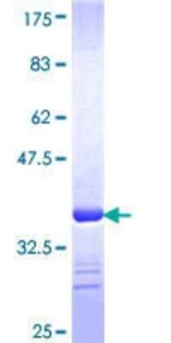 Novus Biologicals Recombinant Human SRp55 GST (N-Term) Protein 25 &mu;g | Buy Online | Novus Biologicals&trade; | Fisher Scientific