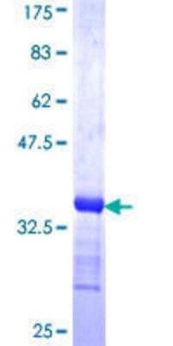 Novus Biologicals Recombinant Human TRA2B GST (N-Term) Protein 25 &mu;g | Buy Online | Novus Biologicals&trade; | Fisher Scientific