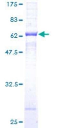 Novus Biologicals Recombinant Human beta Sarcoglycan GST (N-Term) Protein 10 &mu;g | Buy Online | Novus Biologicals&trade; | Fisher Scientific