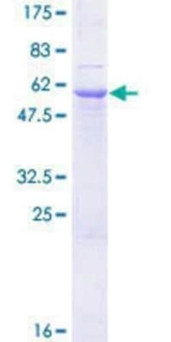 Novus Biologicals Recombinant Human gamma Sarcoglycan GST (N-Term) Protein 25 &mu;g | Buy Online | Novus Biologicals&trade; | Fisher Scientific
