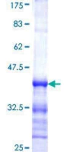 Novus Biologicals Recombinant Human EEN GST (N-Term) Protein 25 &mu;g | Buy Online | Novus Biologicals&trade; | Fisher Scientific