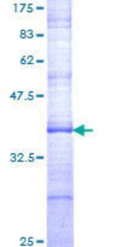 Novus Biologicals Recombinant Human SHFM3 GST (N-Term) Protein 25 &mu;g | Buy Online | Novus Biologicals&trade; | Fisher Scientific
