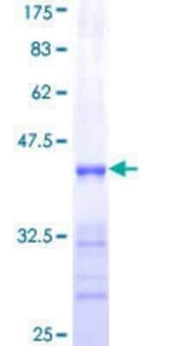 Novus Biologicals Recombinant Human SHOX2 GST (N-Term) Protein 10 &mu;g | Buy Online | Novus Biologicals&trade; | Fisher Scientific