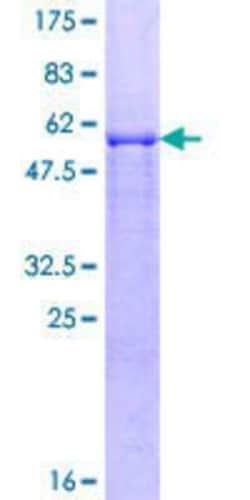Novus Biologicals Recombinant Human SIAH2 GST (N-Term) Protein 10 &mu;g | Buy Online | Novus Biologicals&trade; | Fisher Scientific
