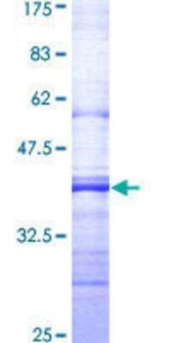 Novus Biologicals Recombinant Human SIAH2 GST (N-Term) Protein 25 &mu;g | Buy Online | Novus Biologicals&trade; | Fisher Scientific