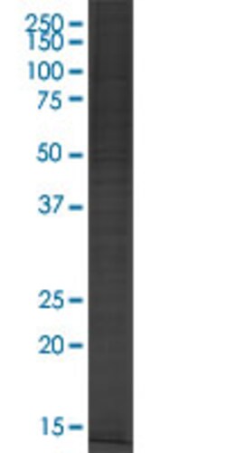 Abnova&trade;&nbsp;ST3GAL1 293T Cell Transient Overexpression Lysate(Denatured)