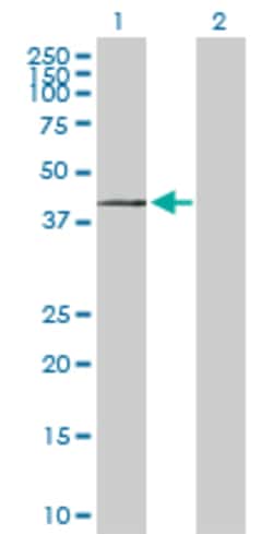 Abnova™ ST3GAL1 293T Cell Transient Overexpression Lysate(Denatured)