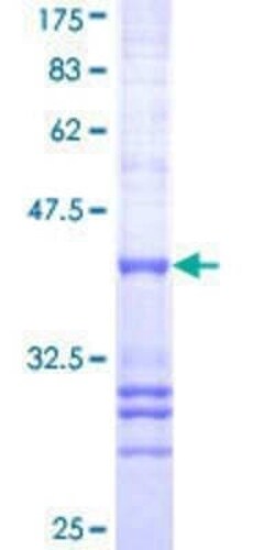Novus Biologicals Recombinant Human SIM1 GST (N-Term) Protein 10 &mu;g | Buy Online | Novus Biologicals&trade; | Fisher Scientific