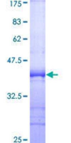 Novus Biologicals Recombinant Human SIPA1 GST (N-Term) Protein 10 &mu;g | Buy Online | Novus Biologicals&trade; | Fisher Scientific