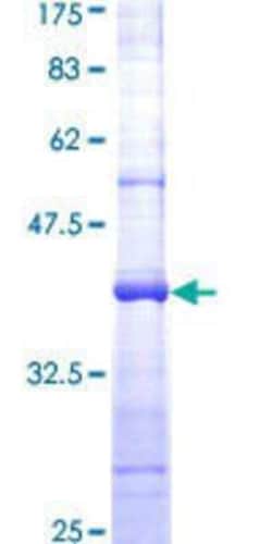 Novus Biologicals Recombinant Human Skp2 GST (N-Term) Protein 10 &mu;g | Buy Online | Novus Biologicals&trade; | Fisher Scientific