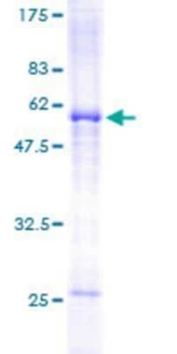 Novus Biologicals Recombinant Human Slap GST (N-Term) Protein 10 &mu;g | Buy Online | Novus Biologicals&trade; | Fisher Scientific
