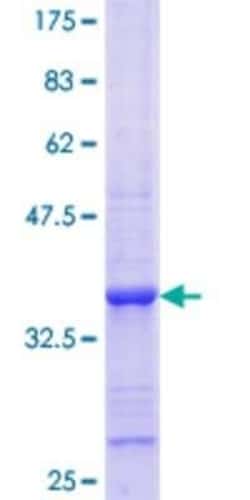 Novus Biologicals Recombinant Human Slap GST (N-Term) Protein 25 &mu;g | Buy Online | Novus Biologicals&trade; | Fisher Scientific
