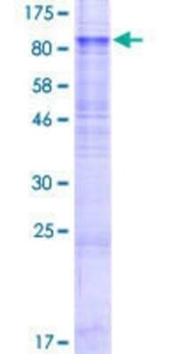 Novus Biologicals Recombinant Human EAAT2/GLT1 GST (N-Term) Protein 2 &mu;g | Buy Online | Novus Biologicals&trade; | Fisher Scientific