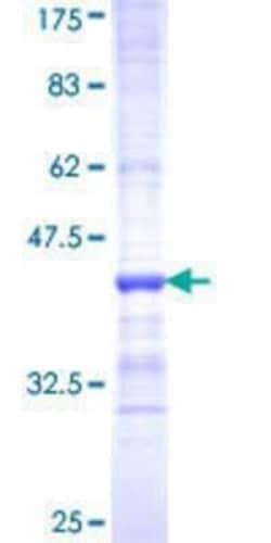 Novus Biologicals Recombinant Human EAAT2/GLT1 GST (N-Term) Protein 10 &mu;g | Buy Online | Novus Biologicals&trade; | Fisher Scientific