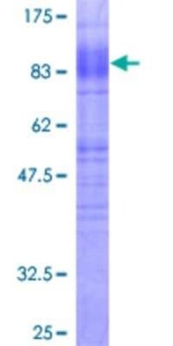Novus Biologicals Recombinant Human EAAT1/GLAST-1/SLC1A3 GST (N-Term) Protein 2 &mu;g | Buy Online | Novus Biologicals&trade; | Fisher Scientific
