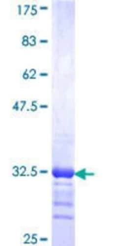 Novus Biologicals Recombinant Human EAAT4 GST (N-Term) Protein 25 &mu;g | Buy Online | Novus Biologicals&trade; | Fisher Scientific