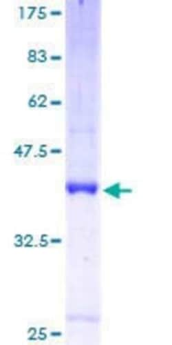 Novus Biologicals Recombinant Human SLC1A7 GST (N-Term) Protein 25 &mu;g | Buy Online | Novus Biologicals&trade; | Fisher Scientific