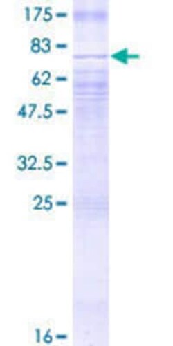 Novus Biologicals&trade;&nbsp;Recombinant Human Glut2 GST (N-Term) Protein