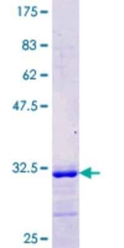 Novus Biologicals Recombinant Human Glut3 GST (N-Term) Protein 10 &mu;g | Buy Online | Novus Biologicals&trade; | Fisher Scientific