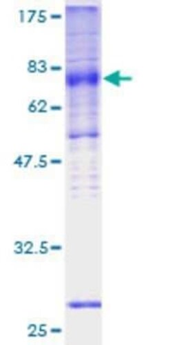 Novus Biologicals Recombinant Human Glut5 GST (N-Term) Protein 2 &mu;g | Buy Online | Novus Biologicals&trade; | Fisher Scientific