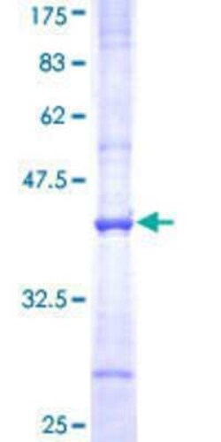 Novus Biologicals Recombinant Human SLC3A1 GST (N-Term) Protein 10 &mu;g | Buy Online | Novus Biologicals&trade; | Fisher Scientific