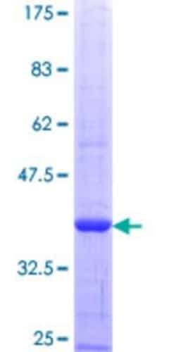 Novus Biologicals Recombinant Human Band 3 GST (N-Term) Protein 10 &mu;g | Buy Online | Novus Biologicals&trade; | Fisher Scientific
