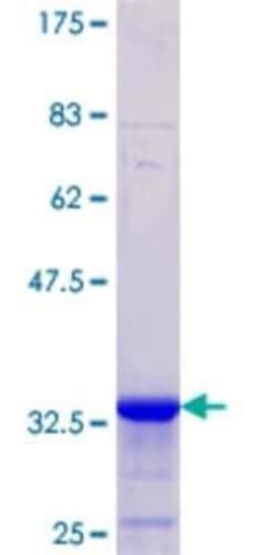 Novus Biologicals Recombinant Human AE2 GST (N-Term) Protein 25 &mu;g | Buy Online | Novus Biologicals&trade; | Fisher Scientific