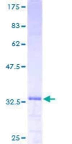 Novus Biologicals Recombinant Human Smoothelin GST (N-Term) Protein 10 &mu;g | Buy Online | Novus Biologicals&trade; | Fisher Scientific