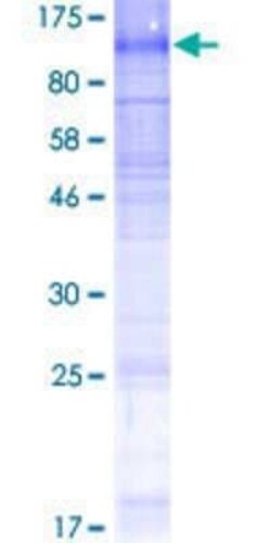 Novus Biologicals Recombinant Human SLC5A3 GST (N-Term) Protein 2 &mu;g | Buy Online | Novus Biologicals&trade; | Fisher Scientific