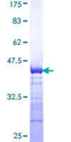 Novus Biologicals Recombinant Human SLC5A3 GST (N-Term) Protein 25 &mu;g | Buy Online | Novus Biologicals&trade; | Fisher Scientific