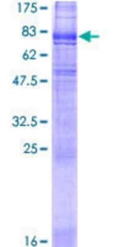 Novus Biologicals Recombinant Human SLC6A3/DAT1 GST (N-Term) Protein 2 &mu;g | Buy Online | Novus Biologicals&trade; | Fisher Scientific