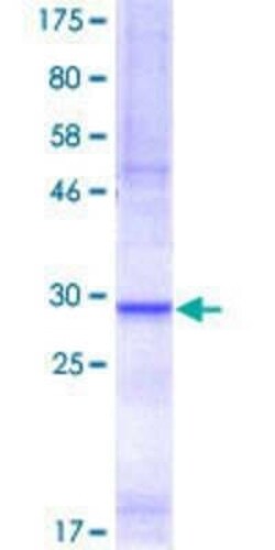Novus Biologicals Recombinant Human SLC6A4/5-HTTLPR/Serotonin transporter GST (N-Term) Protein 10 &mu;g | Buy Online | Novus Biologicals&trade; | Fisher Scientific
