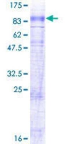 Novus Biologicals Recombinant Human SLC6A7 GST (N-Term) Protein 2 &mu;g | Buy Online | Novus Biologicals&trade; | Fisher Scientific