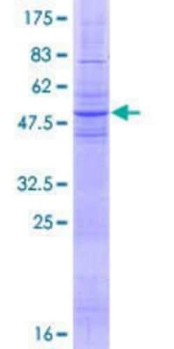 Novus Biologicals Recombinant Human GAT3 GST (N-Term) Protein 25 &mu;g | Buy Online | Novus Biologicals&trade; | Fisher Scientific