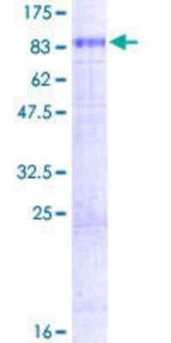 Novus Biologicals Recombinant Human CAT1 GST (N-Term) Protein 2 &mu;g | Buy Online | Novus Biologicals&trade; | Fisher Scientific