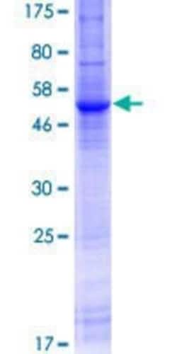 Novus Biologicals Recombinant Human SLC8A3/NCX3 GST (N-Term) Protein 10 &mu;g | Buy Online | Novus Biologicals&trade; | Fisher Scientific