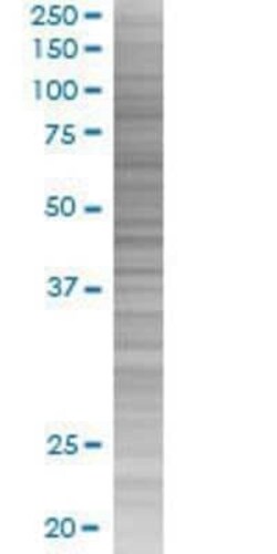 Novus Biologicals NRAMP1/SLC11A1 293T Cell Transient Overexpression Lysate 0.1 mL | Buy Online | Novus Biologicals&trade; | Fisher Scientific