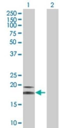 Novus Biologicals NRAMP1/SLC11A1 293T Cell Transient Overexpression Lysate 0.1 mL | Buy Online | Novus Biologicals&trade; | Fisher Scientific