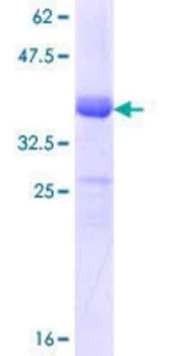 Novus Biologicals Recombinant Human NKCC1/SLC12A2 GST (N-Term) Protein 10 &mu;g | Buy Online | Novus Biologicals&trade; | Fisher Scientific