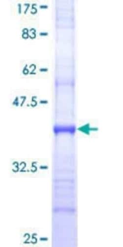 Novus Biologicals Recombinant Human PEPT1/SLC15A1 GST (N-Term) Protein 10 &mu;g | Buy Online | Novus Biologicals&trade; | Fisher Scientific