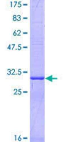 Novus Biologicals Recombinant Human SLC22A3 GST (N-Term) Protein 25 &mu;g | Buy Online | Novus Biologicals&trade; | Fisher Scientific
