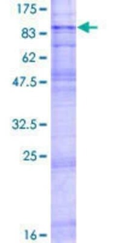 Novus Biologicals Recombinant Human SLC22A2/OCT2 GST (N-Term) Protein 2 &mu;g | Buy Online | Novus Biologicals&trade; | Fisher Scientific